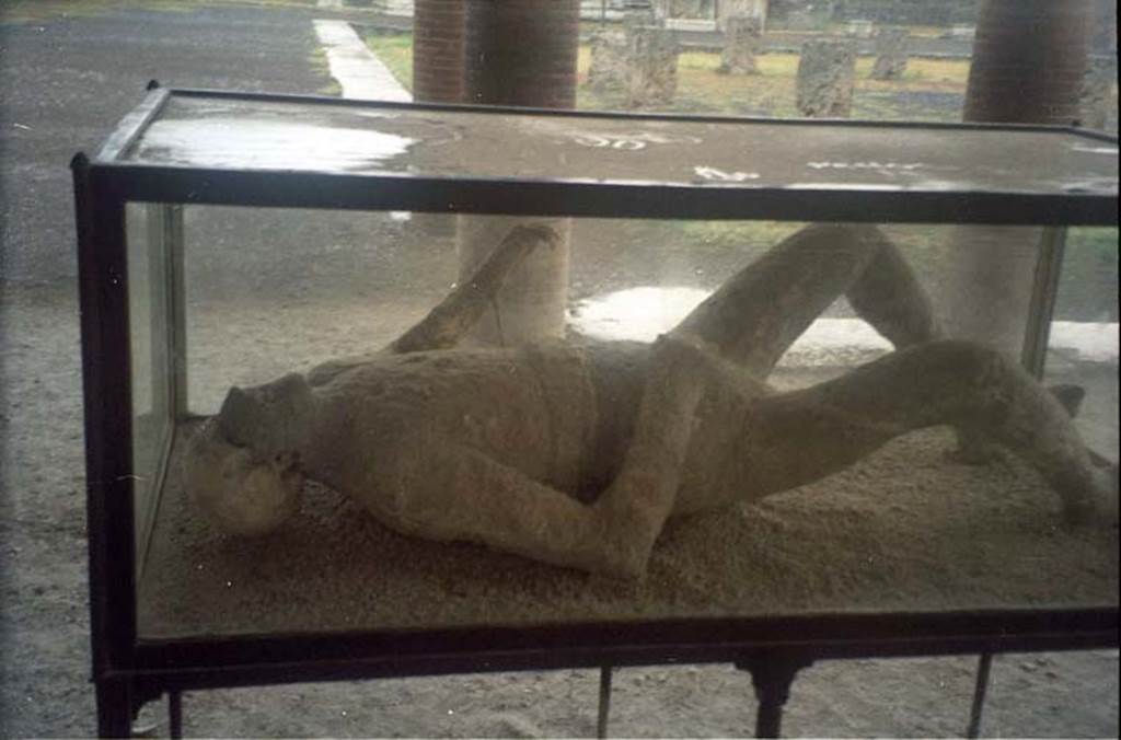 VII.9.7 and VII.9.8 Pompeii. July 2011. Detail of plaster cast of victim number 11, photographed in north-west corner of Macellum. 
Photo courtesy of Rick Bauer.
