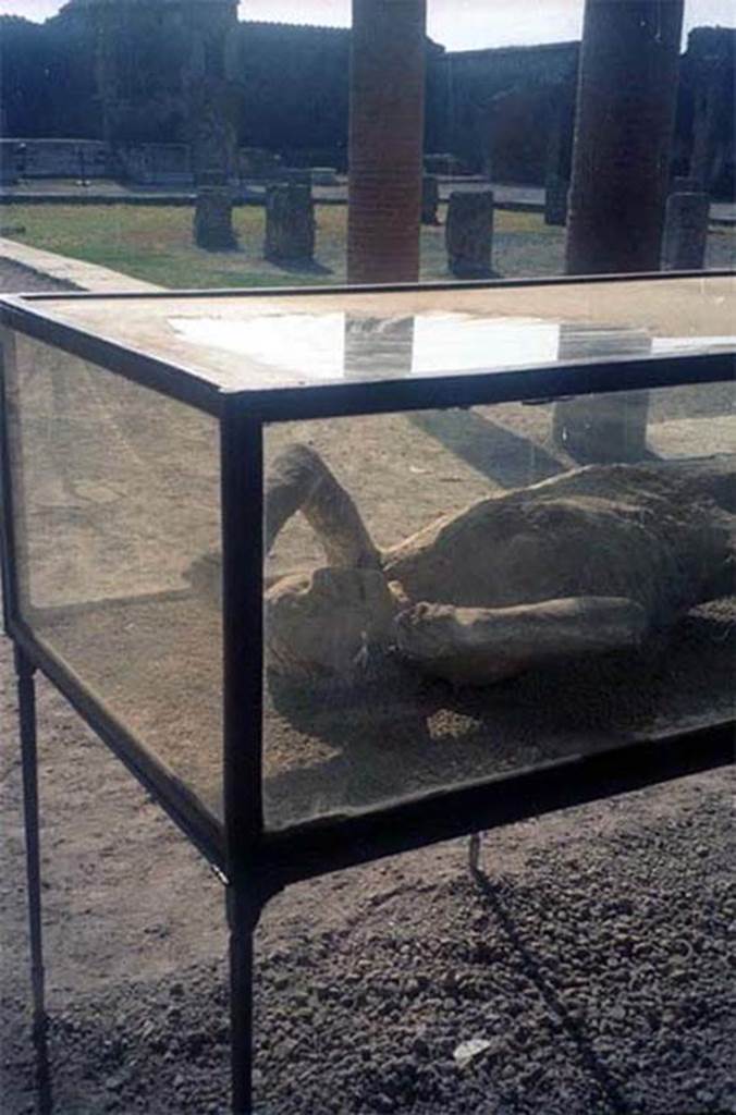 Victim 14. July 2011. Detail from plaster cast on display in north-west corner of Macellum.
Photo courtesy of Rick Bauer.
According to Dwyer, this plaster cast was originally identified as a woman of mature age.
She had been found lying face down on her stomach and half-clothed, her arms stretched before her.
See Dwyer, E., 2010. Pompeii’s Living Statues. Univ. of Michigan Press: (p.106-7)
The victim is now identified as a male of over 20 years of age.
See Osanna, N., Capurso, A., e Masseroli, S. M., 2021. I Calchi di Pompei da Giuseppe Fiorelli ad oggi: Studi e Ricerche del PAP 46, p.348-9, calco n. 14.