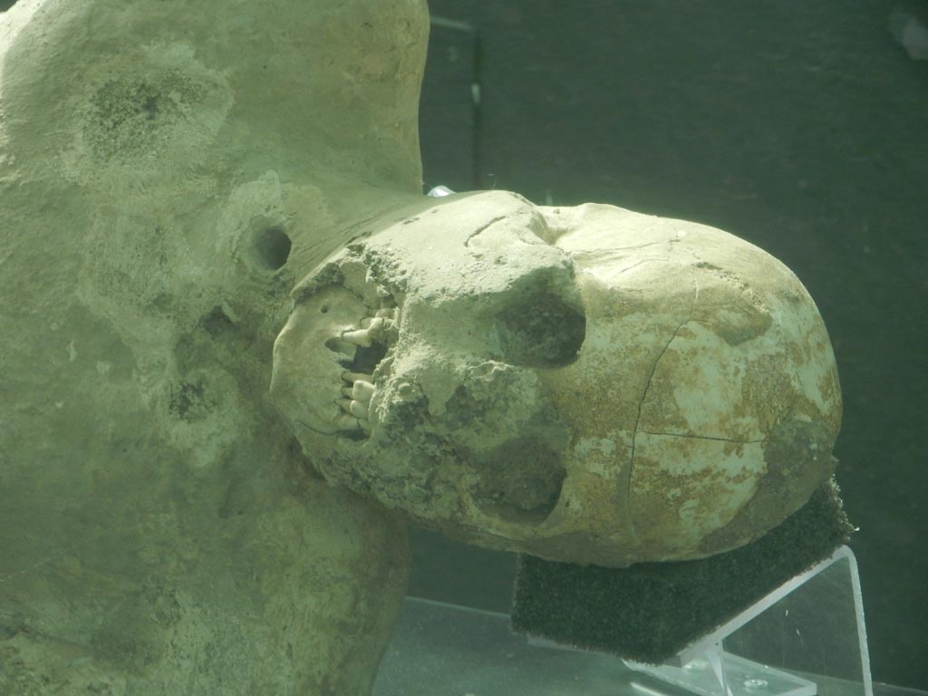 Victim 64. Found outside the Porta Nola between the 28th of July and the 2nd of August 1978. Detail of head.
Photographed in the Piazza Anfiteatro display area, May 2018. Photo courtesy of Buzz Ferebee.

