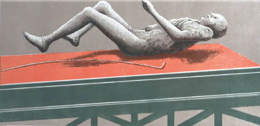 61431 Cast of man Presuhn IV Plate X