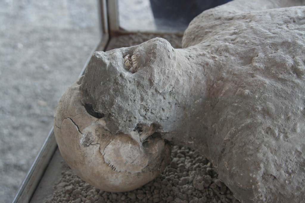 VII.9.7 and VII.9.8 Pompeii. April 2010. Detail of plaster cast of victim no.12, now in north-west corner of Macellum.
Photo courtesy of Klaus Heese.