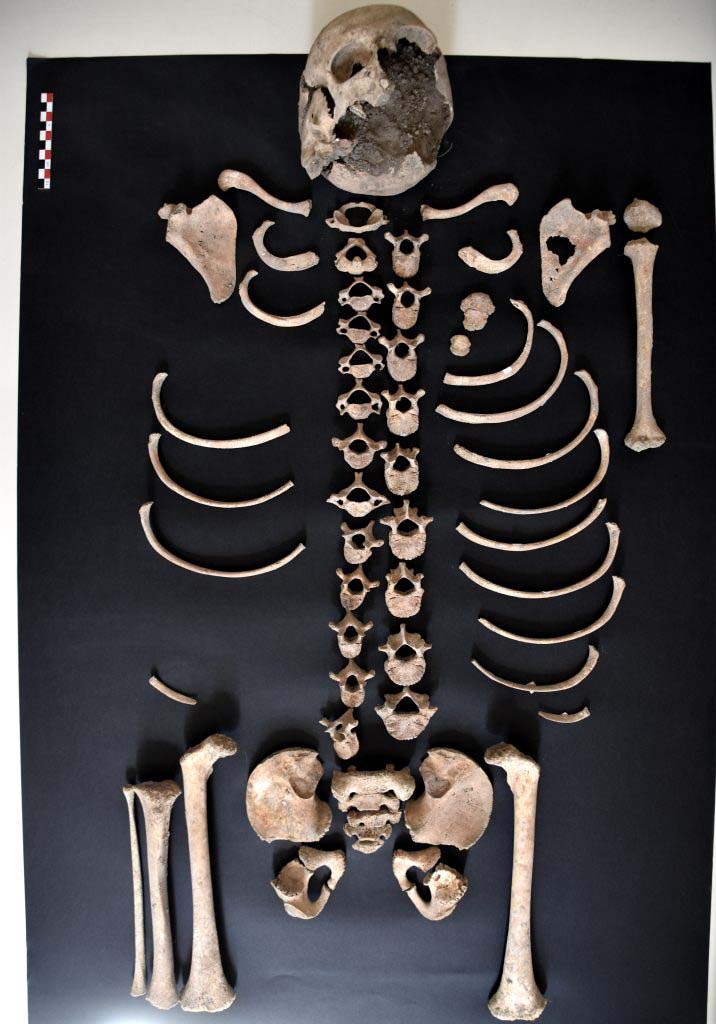 IX.4.18 Pompeii. 2018. Skeleton found outside room “n”.
Laboratory studies of the skeleton based on the measurement of the long bones and on dental development have allowed the PAP to estimate the age as 7-8 years old.
Photograph © Parco Archeologico di Pompei.
